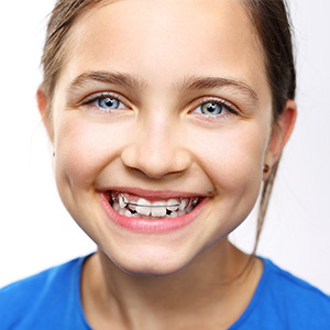 Preteen girl with oral appliance