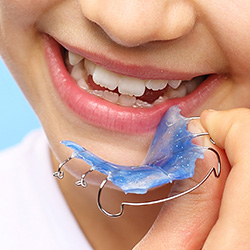Closeup of child placing orthodontic appliance